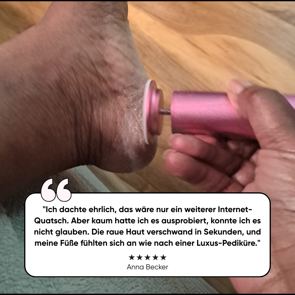 Limaor™ Elektrischer Hornhautentferner