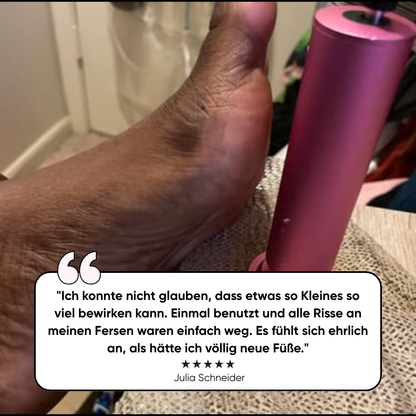 Limaor™ Elektrischer Hornhautentferner